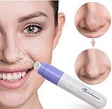 Вакуумный очиститель Pore Cleanser Skin Cleaner для лица, фото 2