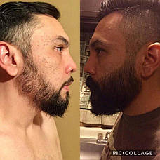 Олія для росту бороди Maxx Beard, фото 5