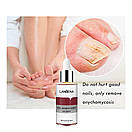 Засіб для лікування та профілактики захворювання нігтів, Lanbena Nail Repair Essence, 15 ml, фото 3