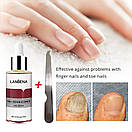 Засіб для лікування та профілактики захворювання нігтів, Lanbena Nail Repair Essence, 15 ml, фото 5