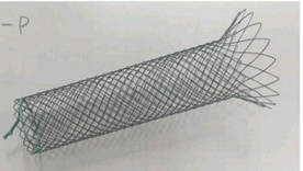 Uncovered stent Tracheal / Стент без покриття Трахеальний, TaeWoong