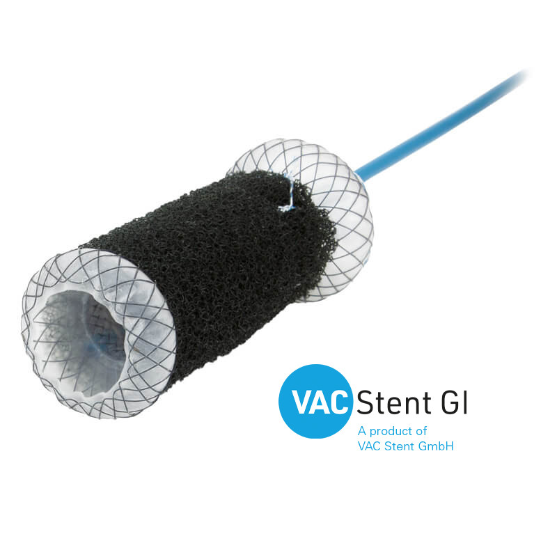 VacStent GI™, MICRO-TECH