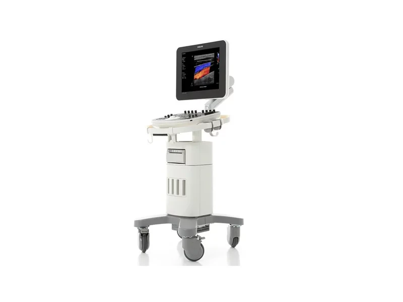Стаціонарний УЗД апарат PHILIPS CLEARVUE 550 (новий)