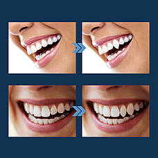М`який пластик для тимчасового протезування зубів EELHOE Temporary Tooth 30мл. Пластик для ліплення EELHOE, полікапролактон, фото 6