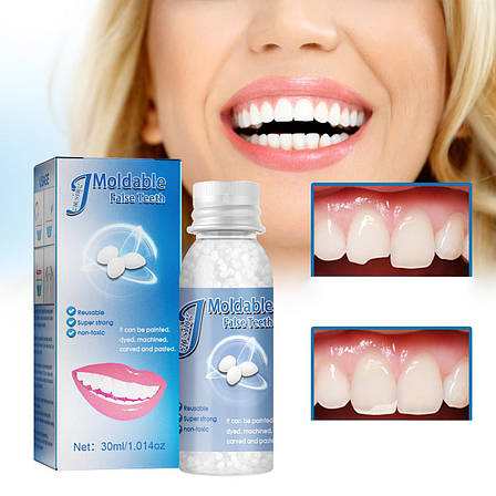 М`який пластик для тимчасового протезування зубів 30мл. Пластик для ліплення, полікапролактон, ПКЛ, фото 2