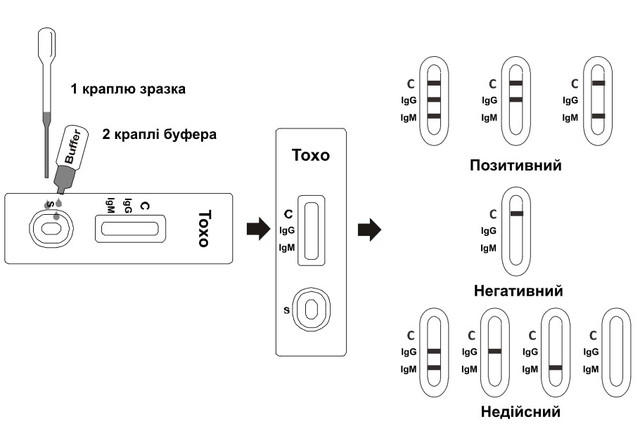 Експрес-тест на токсоплазмоз VITGM-402