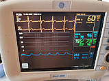 Монітор пацієнта Dash 3000 фірми GE Healthcare (США) БУ, фото 3