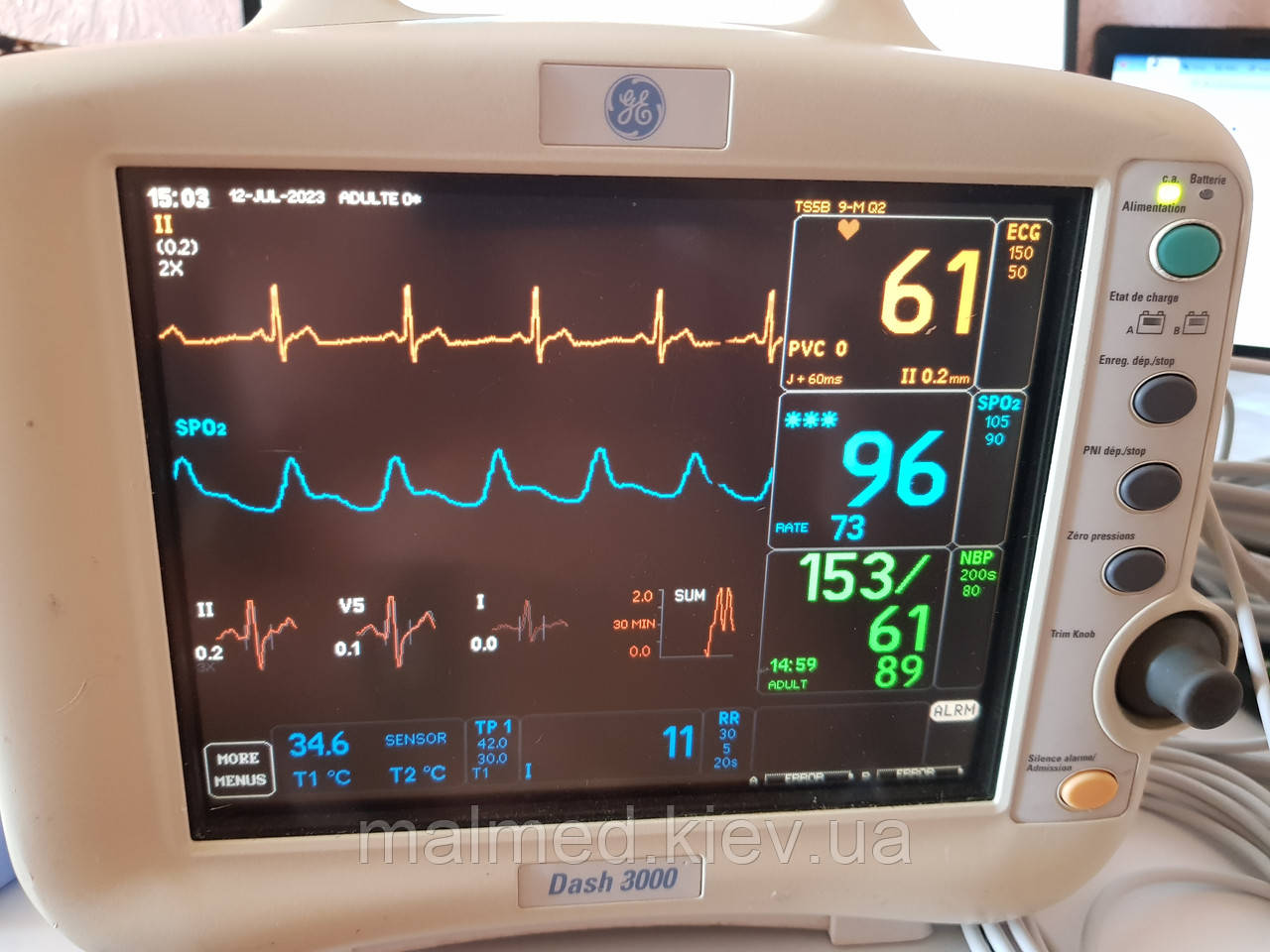 Монітор пацієнта Dash 3000 фірми GE Healthcare (США) БУ