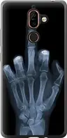 Чехол на Nokia 7 Plus Рука через рентген из силикона FCh_0007833