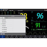 Ветеринарний монітор пацієнта ePM12M Vet, Mindray, Так, Так, Так, Так, Так, Так, Так, фото 3