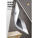 Чохол Supcase для Macbook Pro 16" (2021-23) - Unicorn Beetle Clear, Black (843439116498), фото 6