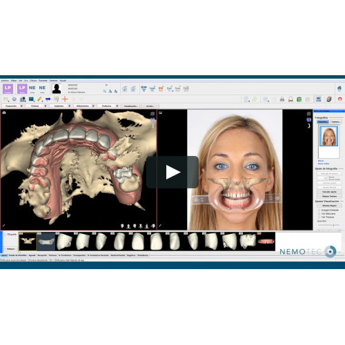 NemoSmile Design 3D, фото 1