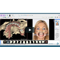 NemoSmile Design 3D
