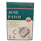 Пластир від прищів та акне 72шт Acne Patch / Косметичні патчі від бородавок та папілом / Пластирі наклейки, фото 10