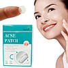 Пластир від прищів та акне 72шт Acne Patch / Косметичні патчі від бородавок та папілом / Пластирі наклейки