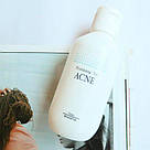Тонер протизапальний для усунення акне Pyunkang Yul ACNE Toner 150 ml, фото 4