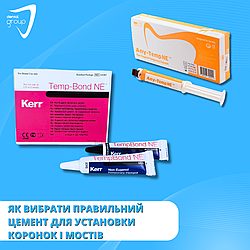 Як вибрати правильний цемент для установки коронок і мостів: основні критерії та рекомендації