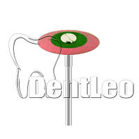 ПОЛІР ДЛЯ ОБРОБКИ ЦИРКОНІЮ Diang Fong - D1F