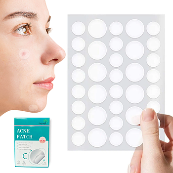 Патчі від прищів та акне 72шт Acne Patch / Прозорий пластир для лікування акне / Протизапальні наклейки
