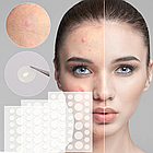 Патчі від прищів та акне 72шт Acne Patch / Прозорий пластир для лікування акне / Протизапальні наклейки, фото 6