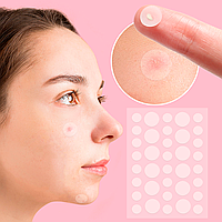 Пластыри от акне и прыщей 72 шт, Acne Patch / Патчи от прыщей