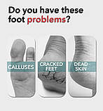 Двостороння терка с напиленням для домашнього педикюру 183, фото 5