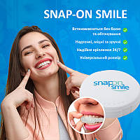 Snap-On Smile вініри,капа, максимально не помітні для оточуючих ТОП ЦІНА