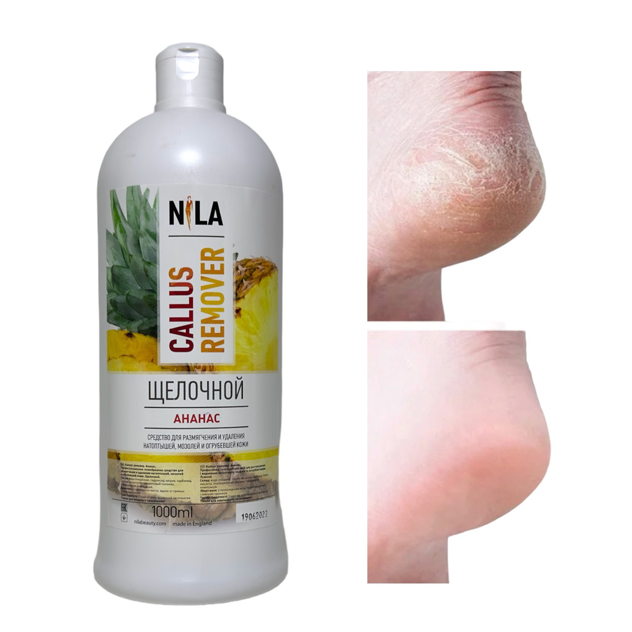 Ремувер для педикюру Nila Callus Remover, ананас, 1000 мл