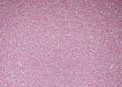 Рідкі Шпалери "Новий-Тон" Тон 9