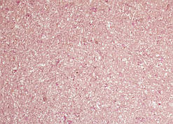 Рідкі Шпалери "Новий-Тон" Тон 10