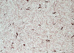 Рідкі Шпалери "Новий-Тон" Тон 18