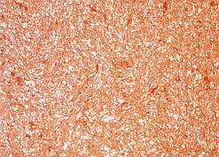 Рідкі Шпалери "Новий-Тон" Тон 20