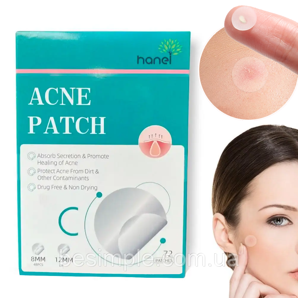 Пластир від прищів та акне 72шт Acne Patch / Косметичні патчі від бородавок та папілом / Пластирі наклейки, фото 1