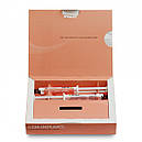 CEM-Implant Auto Mix (цем імплантат) шприц 2х5 мл, насадки, фото 2