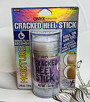 Зволожуючий бальзам для п’ят ONYX Cracked Heel Balm Лаванда