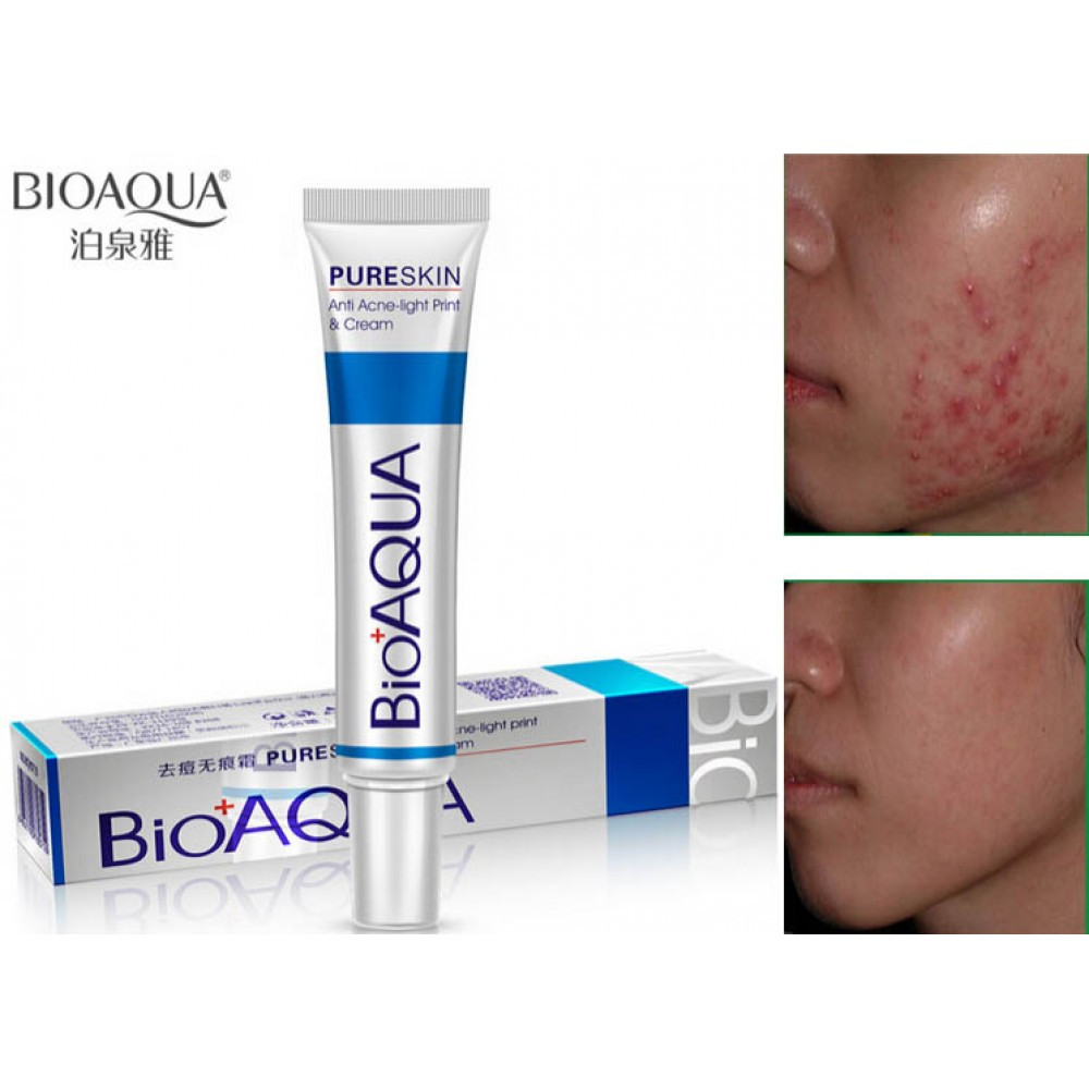 Крем Анти-акне Bioaqua Pure Skin 30г для проблемної шкіри від акне, акне, запалень, рубців, почервоніння