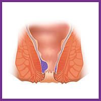 Підтримка судин прямої кишки