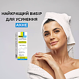 Пінка для вмивання проти акне перолайт Perolite Benzoyl Peroxide 2% Acne Foaming Face Wash 100 мл, фото 3