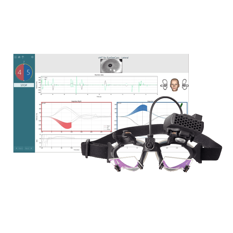 Прилад EyeSeeCam vHIT (вимірювання вестибулоокулярного рефлексу (VOR))