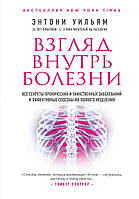 Взгляд внутрь болезни. Все секреты хронических и таинственных заболеваний и эффективные способы их полного