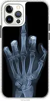 Чехол с принтом для Apple iPhone 12 Pro / на айфон 12 про с рисунком Рука через рентген Бампер
