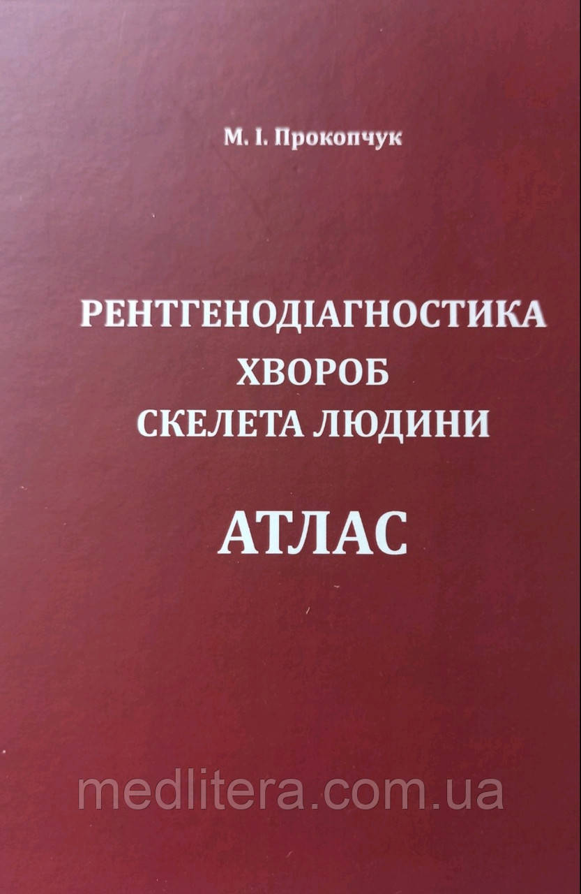 Прокопчук М І. Рентгенодиагностика хвороб скелета людини