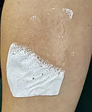 Розчинна колагенова серветка/патч-набір 3 шт., фото 4