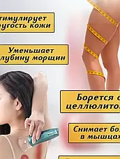 Масажні вакуумні банки для домашньої терапії 6 шт., Лімфодренажний масажер банки 6 шт., фото 2