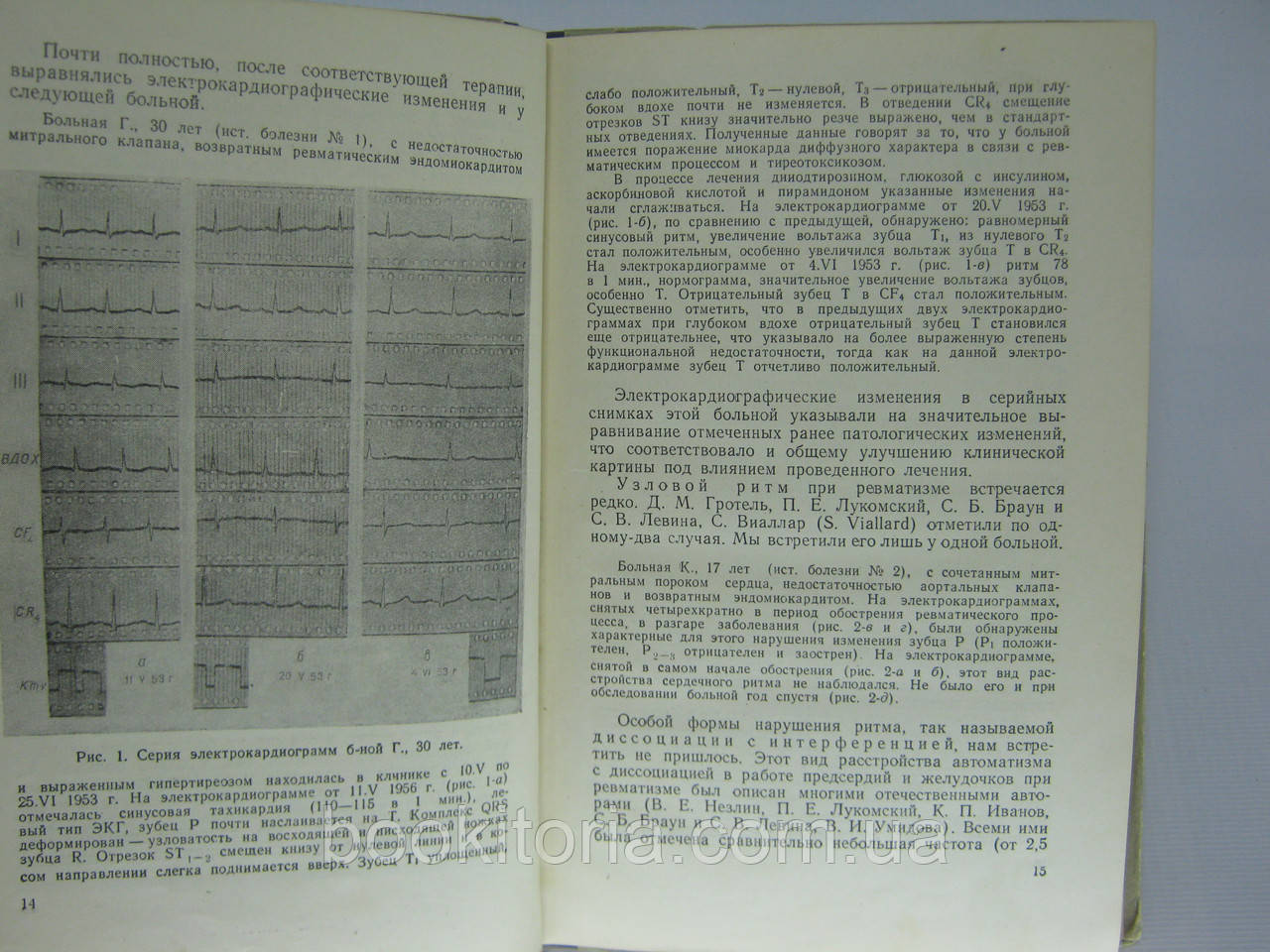 Ясиновский М., Бойко Г.Ф. Изменения сердца при ревматизме (по электрокардиографическим данным) (б/у) - фото 5 - id-p344630280