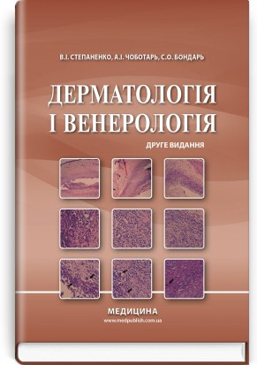 Інфекційні хвороби у дітей: підручник / С.О. Крамарьов, О.Б. Надрага, О.Р. Буц та ін. — 3-є видання