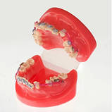 Модель демонстраційна ортодонтична з керамічними брекетами, фото 3