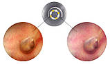 Отоскоп LuxaScope Auris CCT LED 2.5В, чорний, Luxamed, фото 3