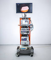 Б/У Комплект для ендоскопії Smith & Nephew HD Endoscope Set 660HD Image System 500XL Xenon Lighte Source