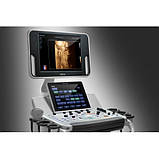 Стаціонарний УЗД апарат високого класу Mindray DC-40, фото 7